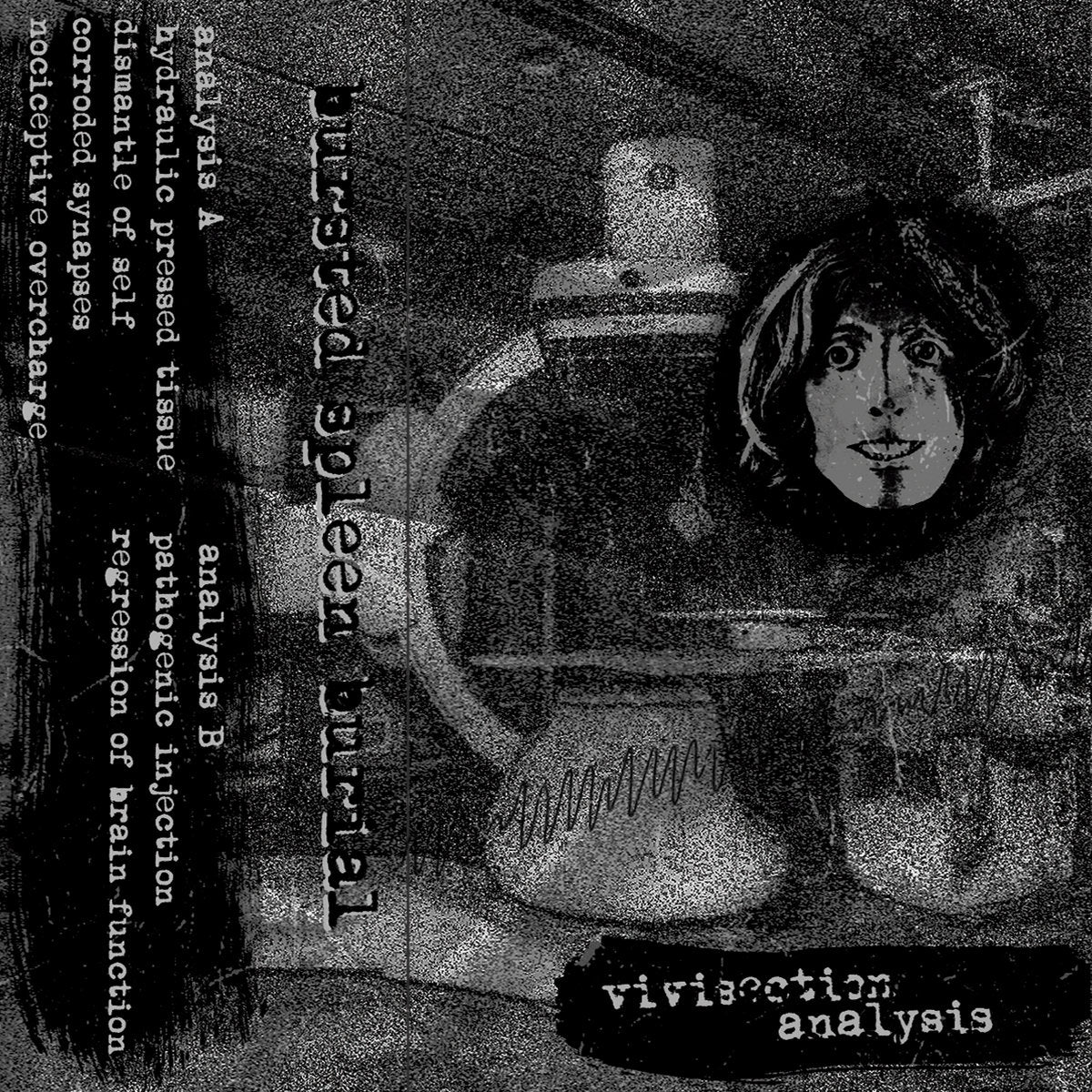 Bursted Spleen Burial - Vivisection Analysis (Cassette)